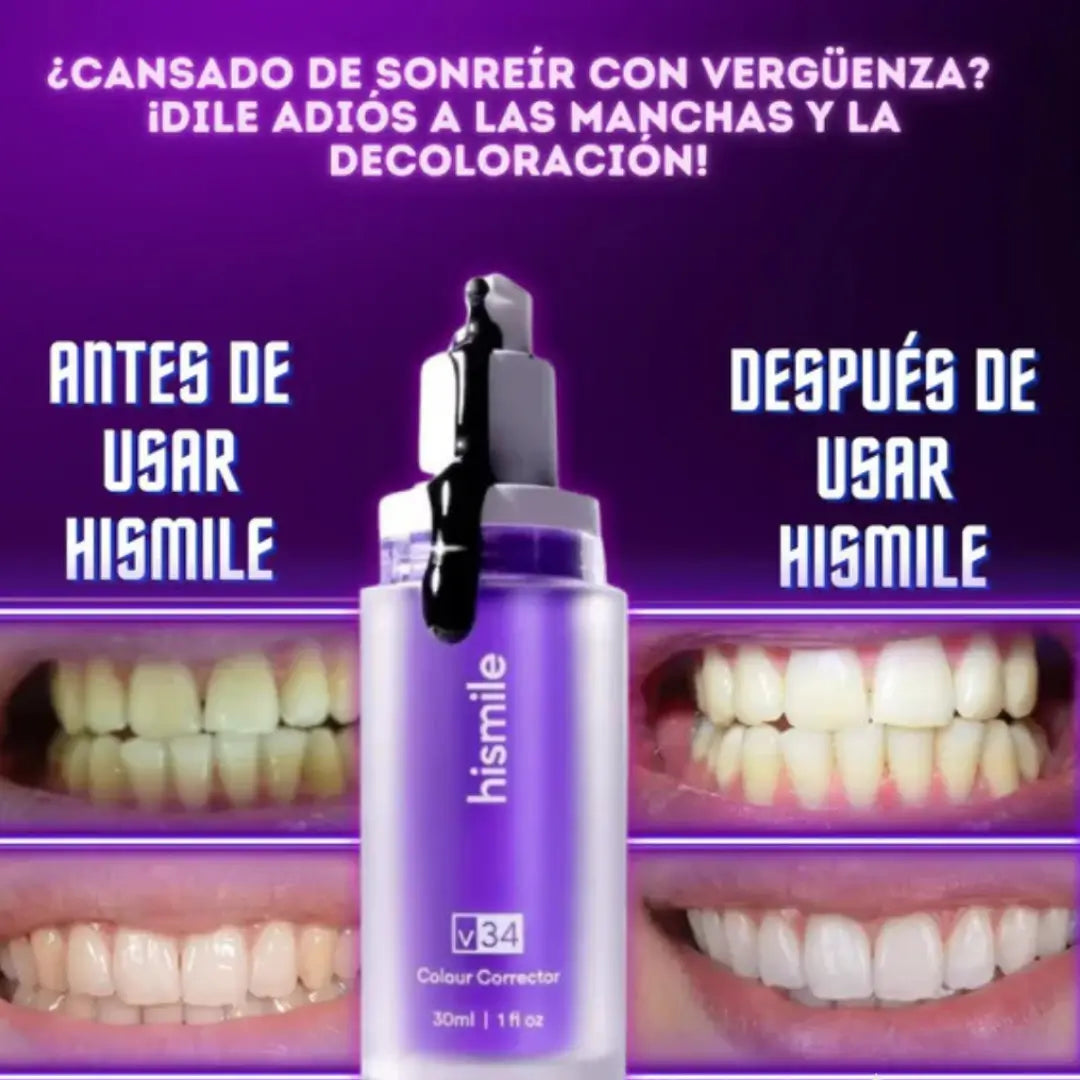 Hismile V34: Sonríe más blanco en 5 min sin peróxido
